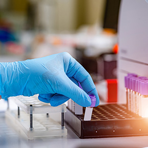 BIOPSIA POR ASPIRACION