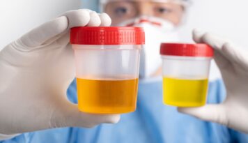 Programas de detección de drogas en el trabajo - Laboratorio Proquimed