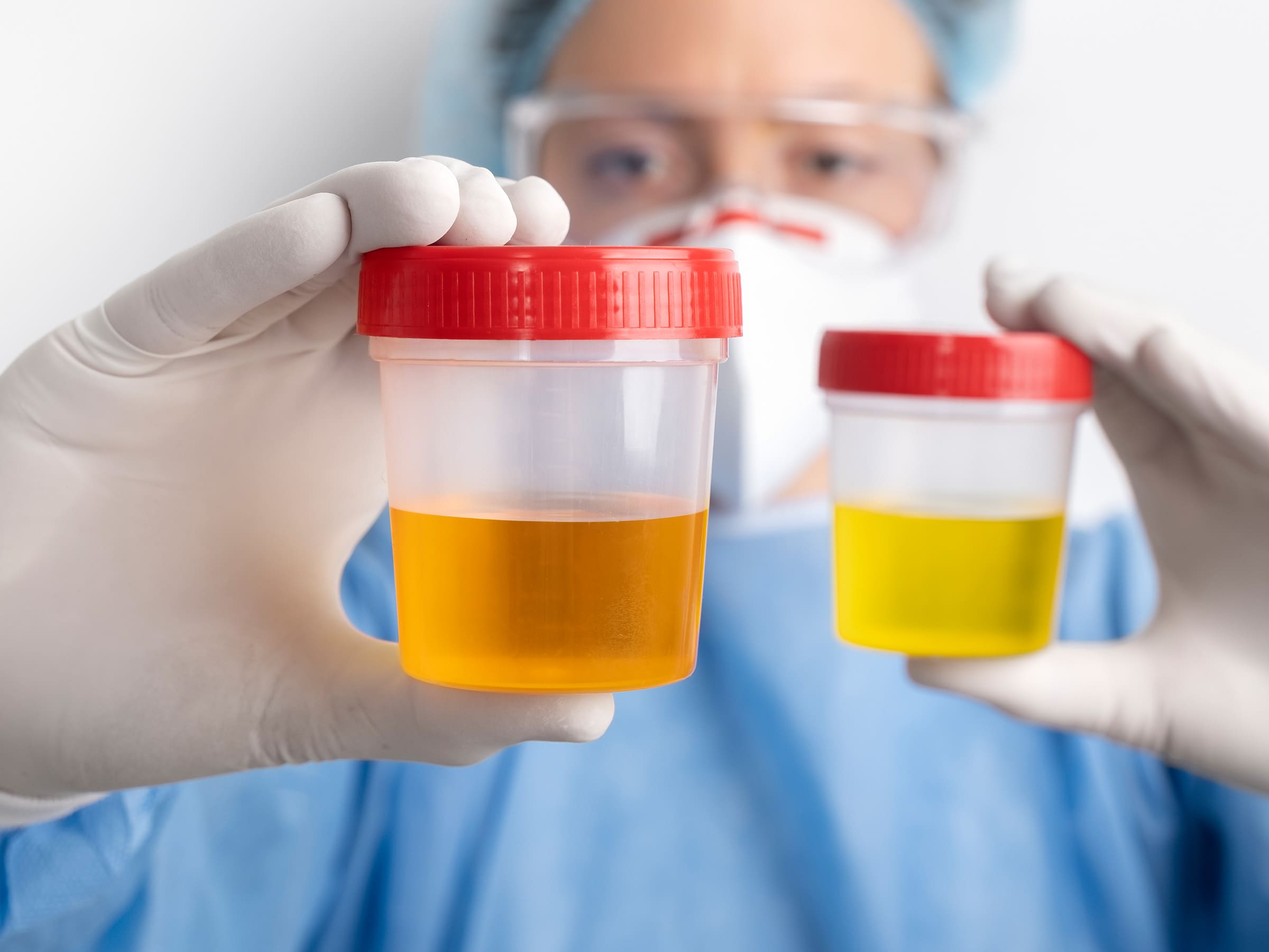 Programas de detección de drogas en el trabajo - Laboratorio Proquimed