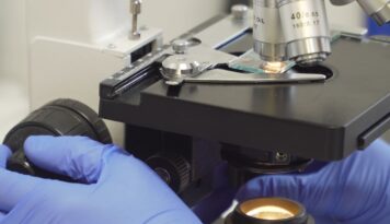 Reacciones febriles - Laboratorio Proquimed